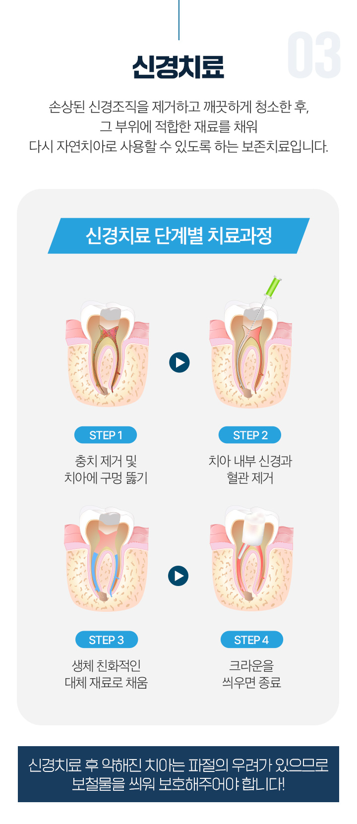 신경치료