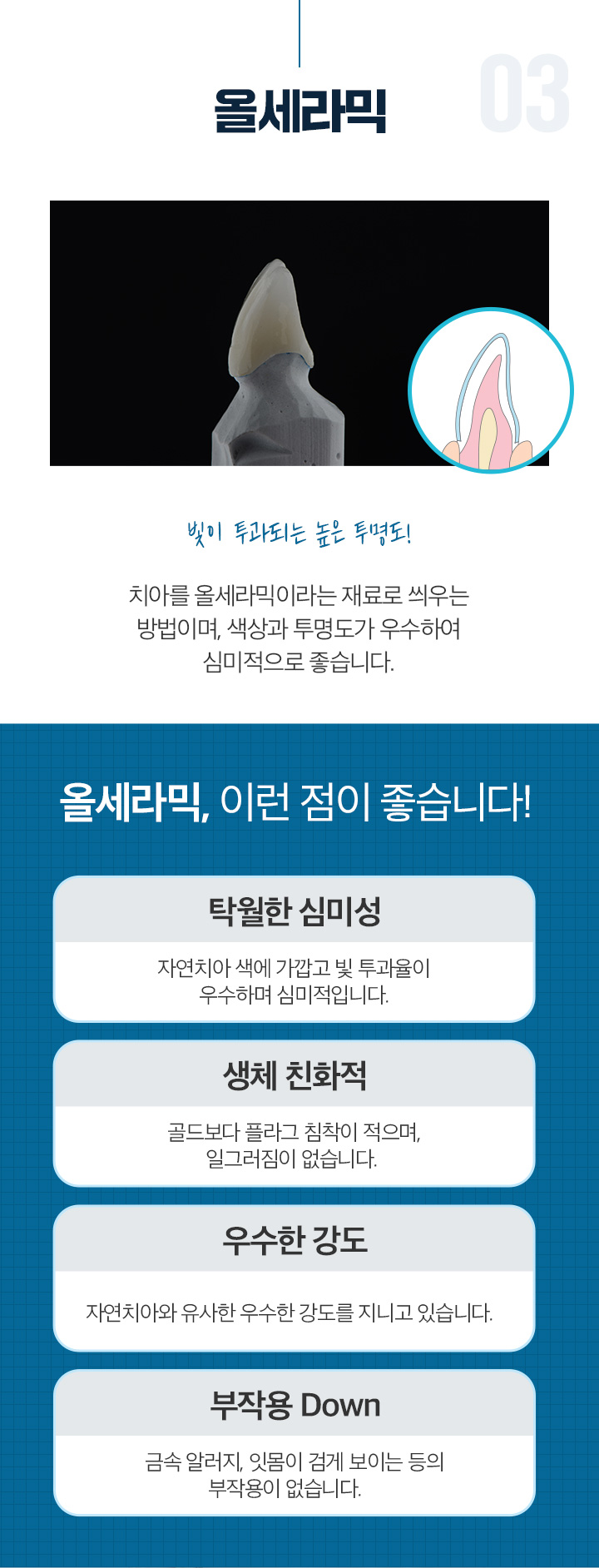 올세라믹